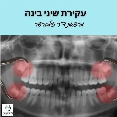 עקירת שיני בינה | מרפאת ד"ר זילברשר