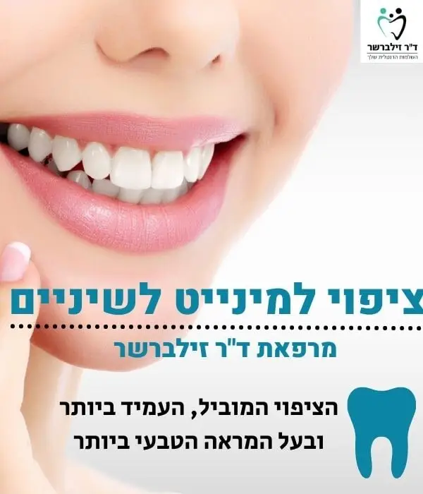 ציפוי למינייט לשיניים