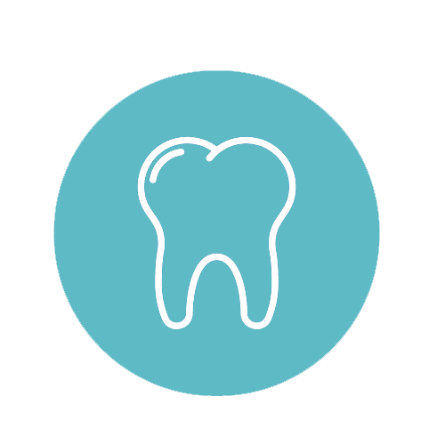 ציפוי למינייט