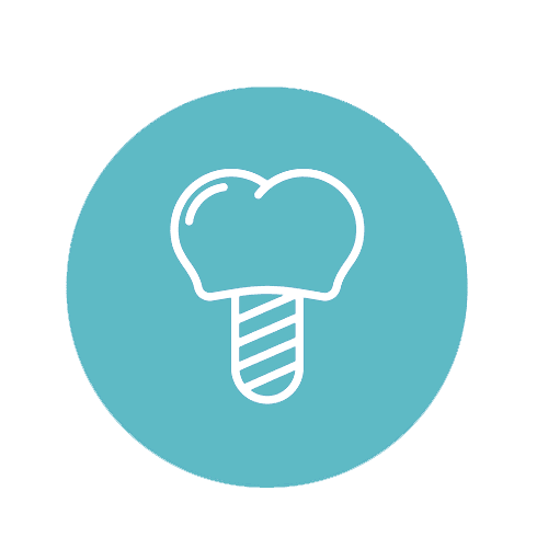 שתלים דנטליים