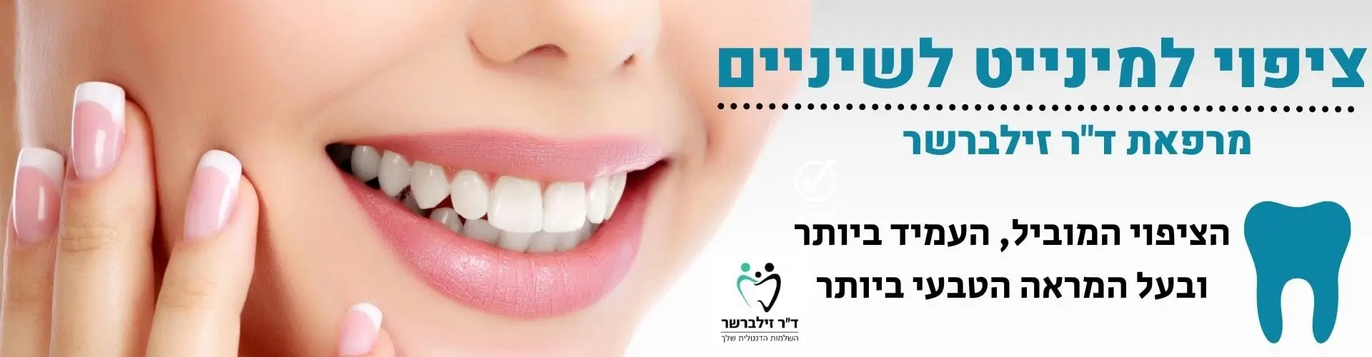 ציפוי למינייט לשיניים