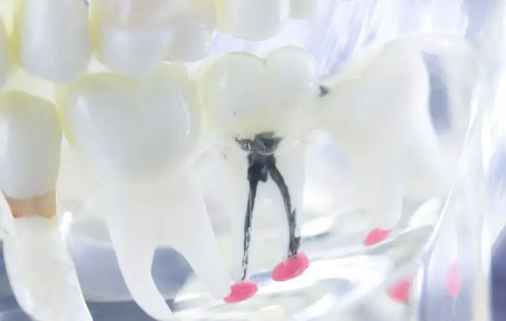 טיפולי שורש החלמה